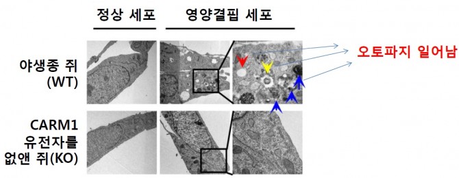 쥐의 세포를 투과전자현미경으로 관찰한 모습. 일반 쥐의 영양결핍 세포에서는 자가포식(오토파지) 현상이 일어난다(위쪽 사진들). CARM1 단백질의 유전자를 없앤 쥐는 영양결핍이 결핍해도 자가포식 현상이 일어나지 않는다. - 서울대 제공
